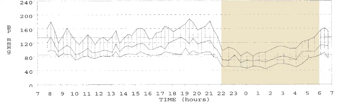 Záznam tlaku za 24 hodin: po 22. hodině systolický tlak prudce klesá z denních 140–160 na 80–110 mmHg