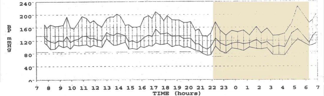 Záznam tlaku za 24 hodin: v noci tlak neklesá a mezi 4. a 5. hodinou ranní systolický tlak vystoupá ze 140 na asi 230 mmHg